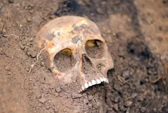 человеческий череп